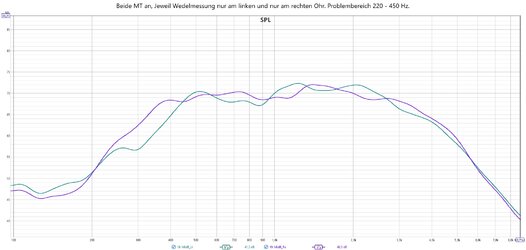 Beide MT an, Wedelmessungen nur linkes und rechtes Ohr.jpg